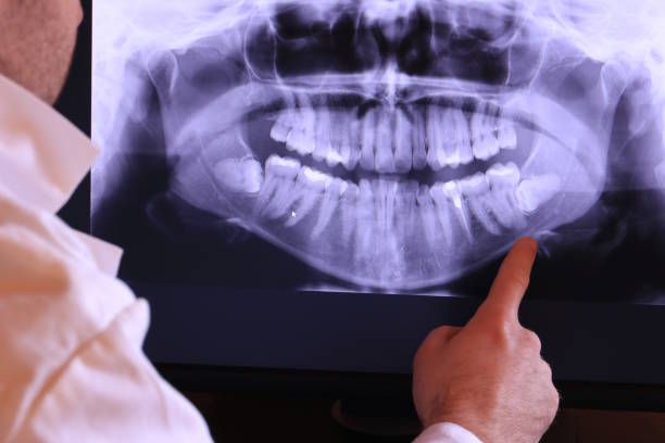 Best Emergency Root Canal Treatment in Gray, TN