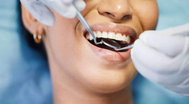 Best Emergency Dental Care for Broken or Chipped Teeth in Gray, TN
